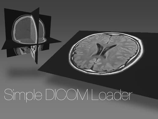 Simple DICOM Loader